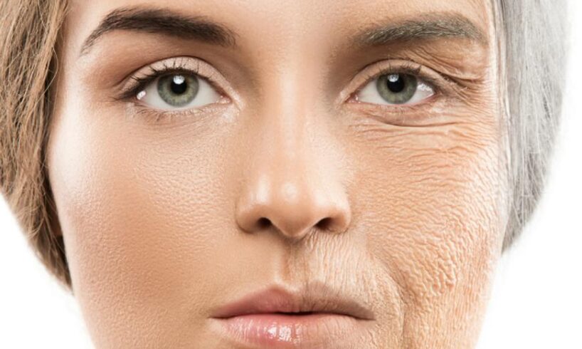 Premature Skin Aging